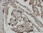 MSI1 Antibody (monoclonal) (M04)